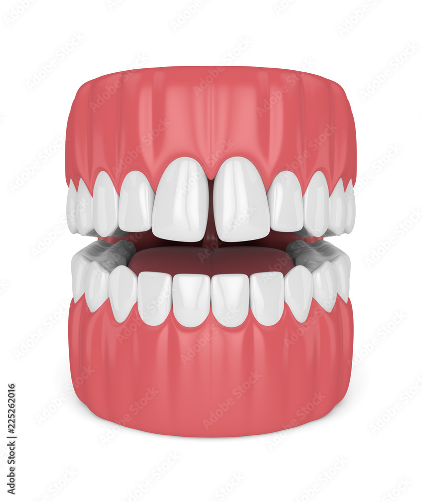 3d render of teeth with diastema 3d render of teeth with diastema