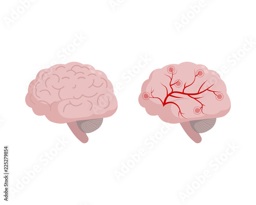 Healthy Brain icon isolated on white background, medical illustration in flat design. Cerebral circulation and spasm of cerebral arteries and veins supplying the brain, migraine, headache concept.