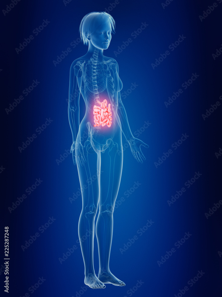 3d rendered medically accurate illustration of a females painful intestine 3d rendered medically accurate illustration of a females painful intestine