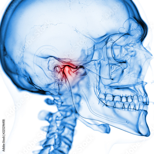 Slika na platnu 3d rendered medically accurate illustration of the temporomandibular joint