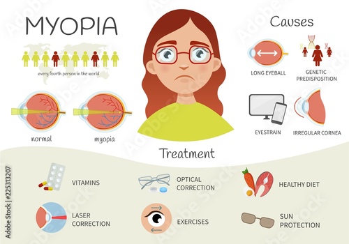 Infographics of myopia. Defects of vision. Illustration of a cute girl with glasses. Causes and treatment of the disease. photo