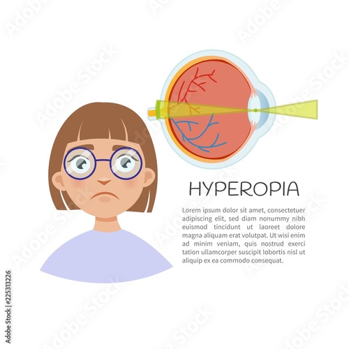 Vector illustration. Defects of vision hyperopia. Cute girl with glasses.