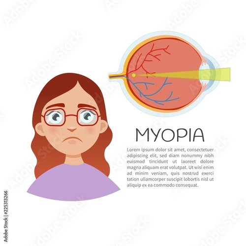 Vector illustration. Defects of vision myopia. Cute girl with glasses.