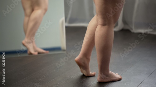 Obese ladys feet, unhealthy woman suffering excess weight and varicose veins