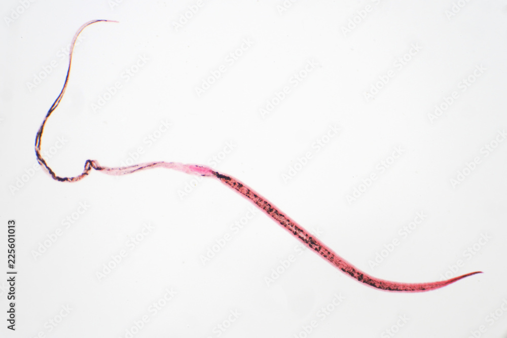 whipworm (Trichuris trichiura) is parasitic helminthic nematode