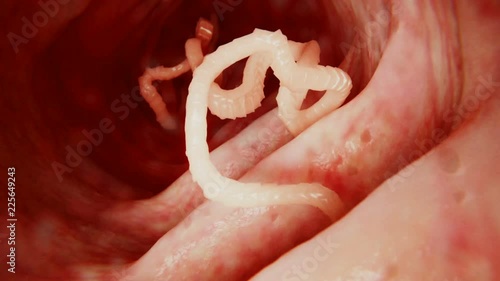 Tapeworm in the intestines, animation photo