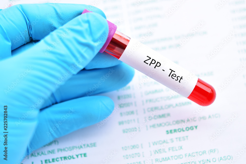 Blood sample tube for ZPP or zinc protoporphyrin test, diagnosis for