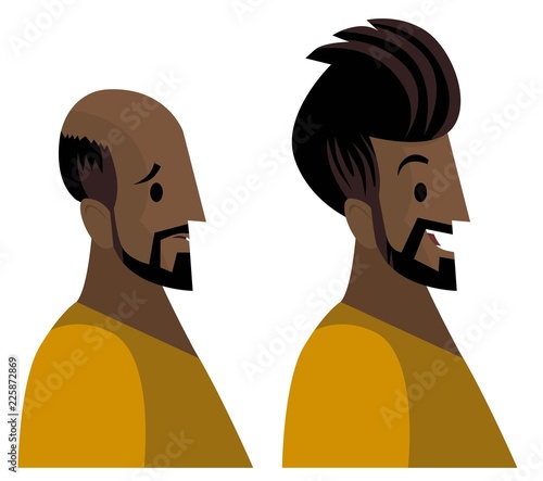 hair loss treatment