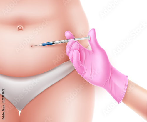 Vector liposuction surgery doctor hand and syringe
