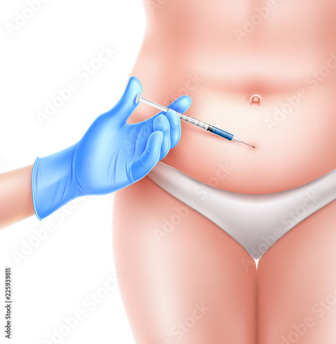 Vector liposuction surgery doctor hand and syringe