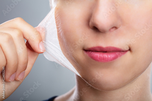 Woman Removing Peeling Mask From Her Face photo