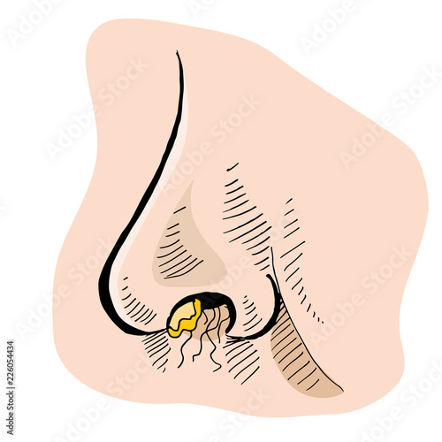 Crusty Boogers Hairy Nostril Nose