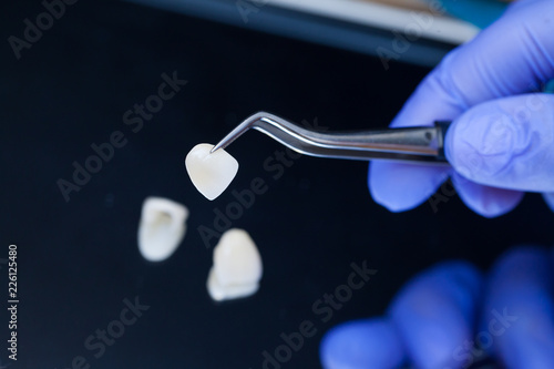 A dentist is holding tweezers for dental ceramic veneers and crowns. photo