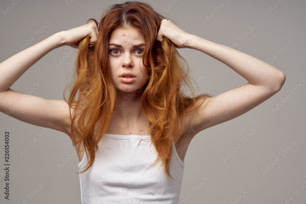 woman with big eyes on acne face woman with big eyes on acne face
