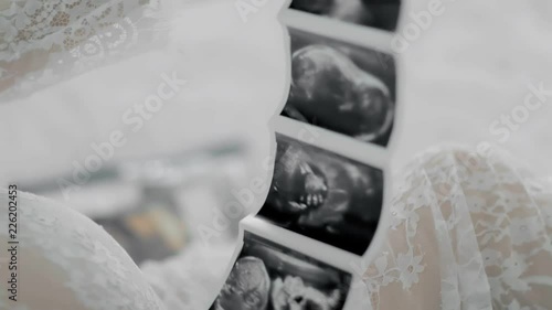 pregnant woman ultrasound photo photo