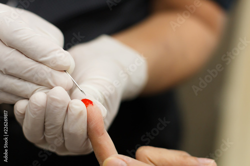 Blood test for HIV Aids