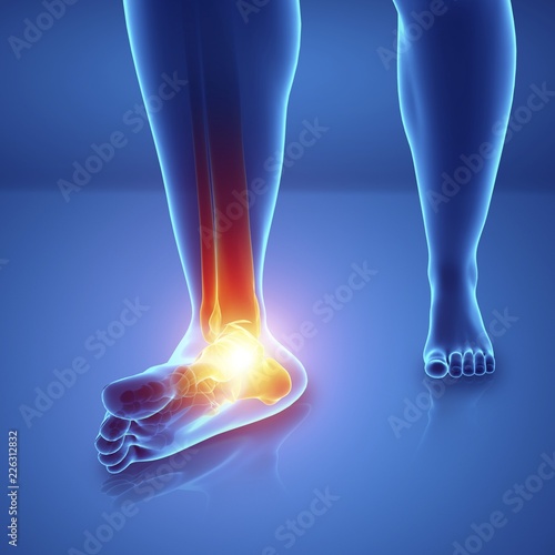 Man with foot pain, illustration photo