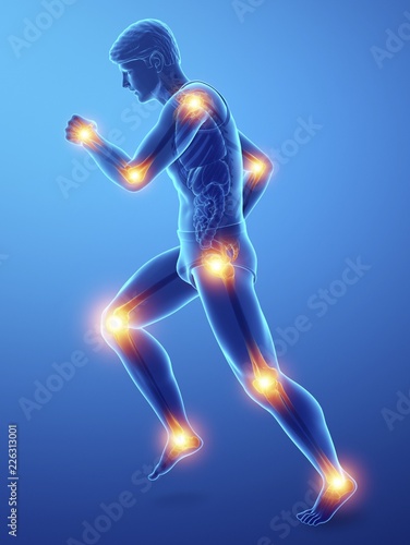 Man with joint pain, illustration