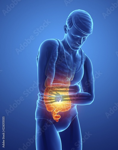 Man with abdominal pain, illustration