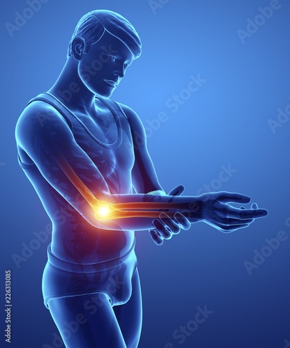 Man with elbow pain, illustration photo