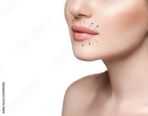 sensual beautiful woman lips after lip augmentation