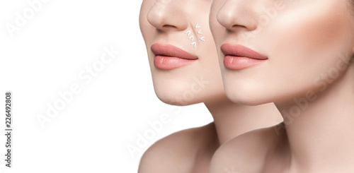 Cropped part woman face before and after rejuvenation procedure