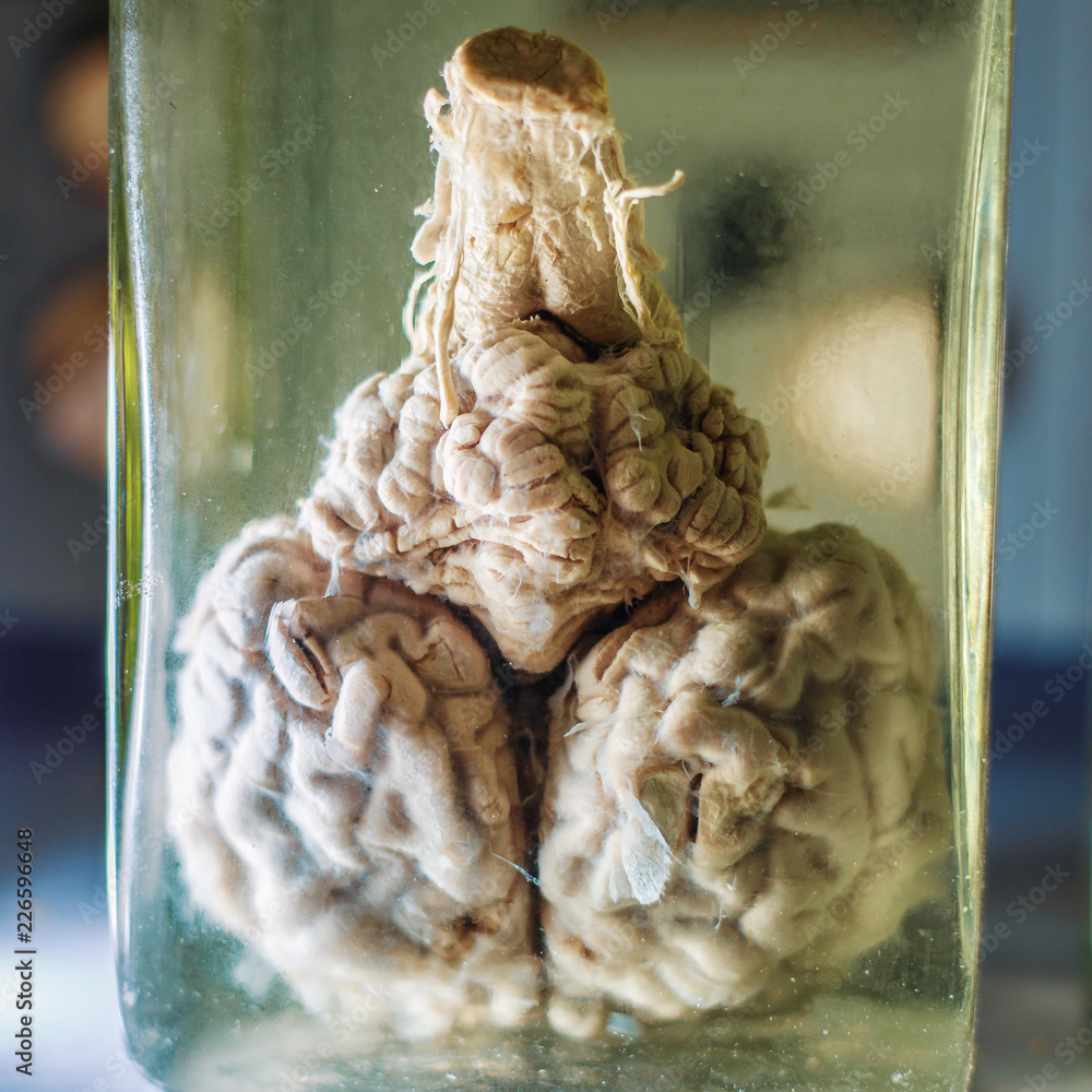 Reserved animal brain in liquid formaldehyde in glass jar in scientific  veterinary laboratory Stock Photo | Adobe Stock