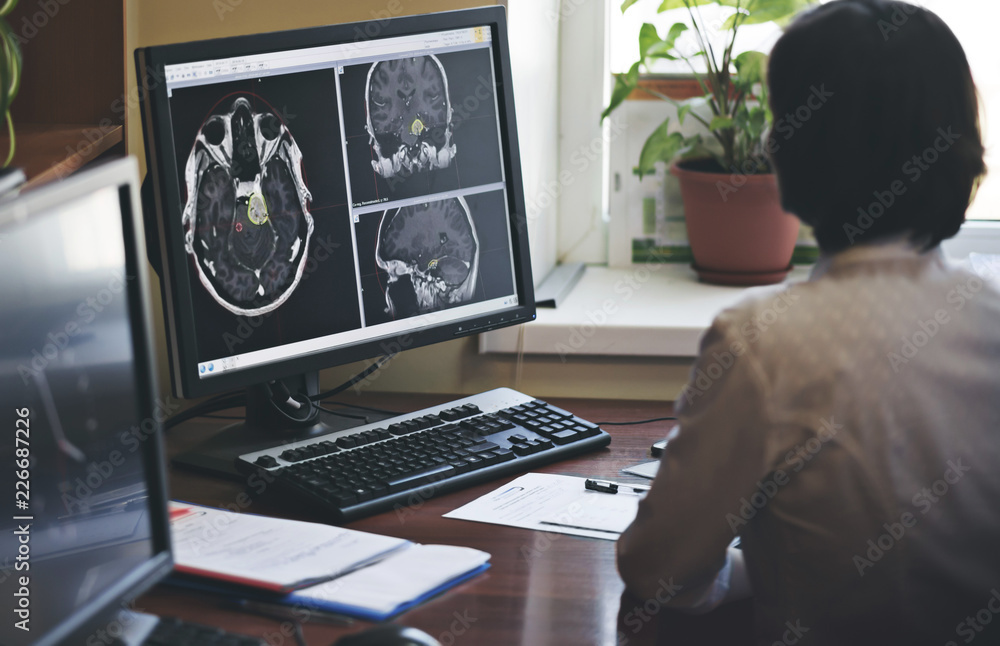 A radiologist is working on a CT scan of a brain tumor A radiologist is working on a CT scan of a brain tumor