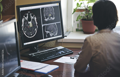 A radiologist is working on a CT scan of a brain tumor photo