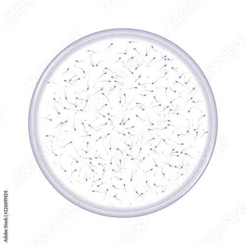 Sperms in petri dish