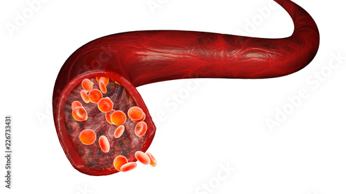 Globuli rossi e flusso di sangue attraverso una vena, piccole cellule sferiche che contengono l’emoglobina, proteina che da’ il colore rosso al sangue photo