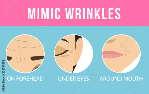 Women anti-aging skin care. Different types of facial wrinkles. Age-related skin changes. Vector