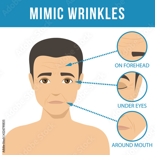 Man anti-aging skin care and men cosmetics. Different types of facial wrinkles, mimic wrinkles. Age-related skin changes. Vector