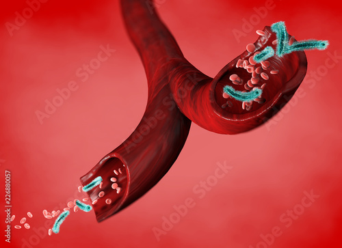 Vena e globuli rossi attaccati da un virus, circolazione di batteri all’interno di un’arteria. Escherichia coli. Sezione di una vena. 3d rendering photo