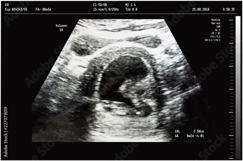 An ultrasound of a mother fetus during the 08th week background as Medical and Health of the baby concept. vector illustration.