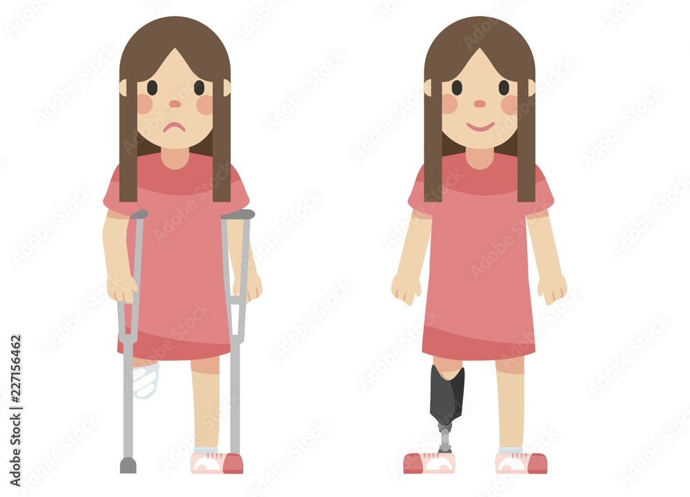 disabled girl with a prosthetic leg and crutches disabled girl with a prosthetic leg and crutches
