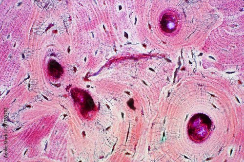 Foto Histology of human compact bone tissue under microscope view for education