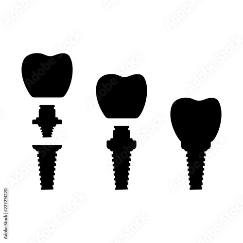 Photos Dental implant system