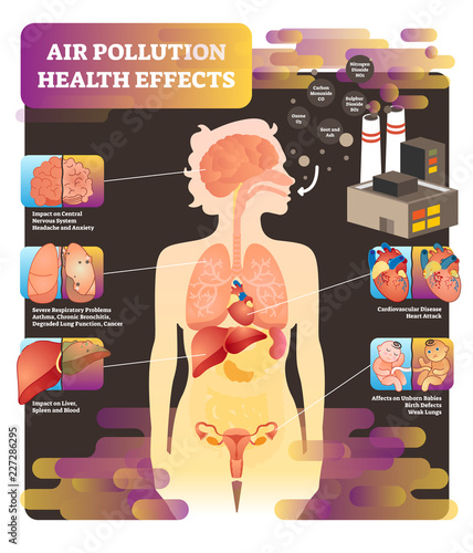 Air pollution health effect vector illustration. Cause of lung problem