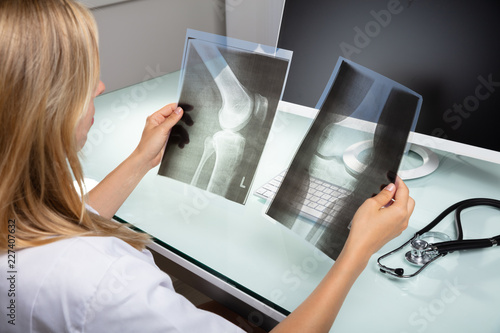 Doctor Examining Knee X-ray