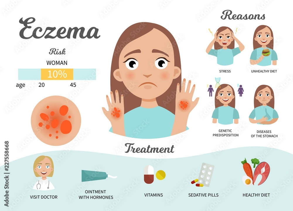 Infographics of eczema. Statistics, causes, treatment of the disease. Illustration of a cute sad