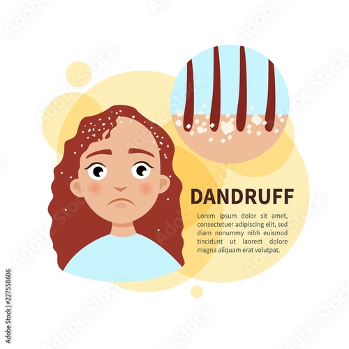 Vector poster. Dandruff. Sad cute girl. Disease of the skin.