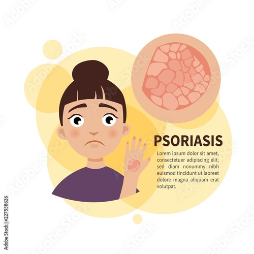 Vector poster. Psoriasis. Sad cute girl. Disease of the skin.