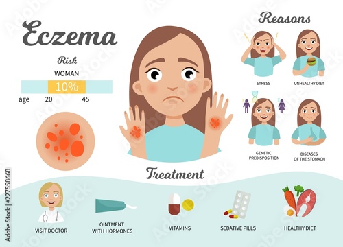 Infographics of eczema. Statistics, causes, treatment of the disease. Illustration of a cute sad girl.