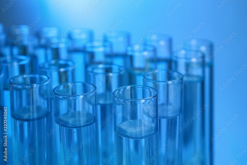 Test tubes with liquid against color background, closeup. Laboratory analysis Test tubes with liquid against color background, closeup. Laboratory analysis