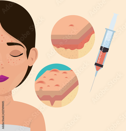 woman with botox treatment