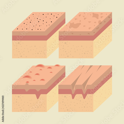 layers of skin types