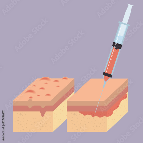 layers of skin with botox injection