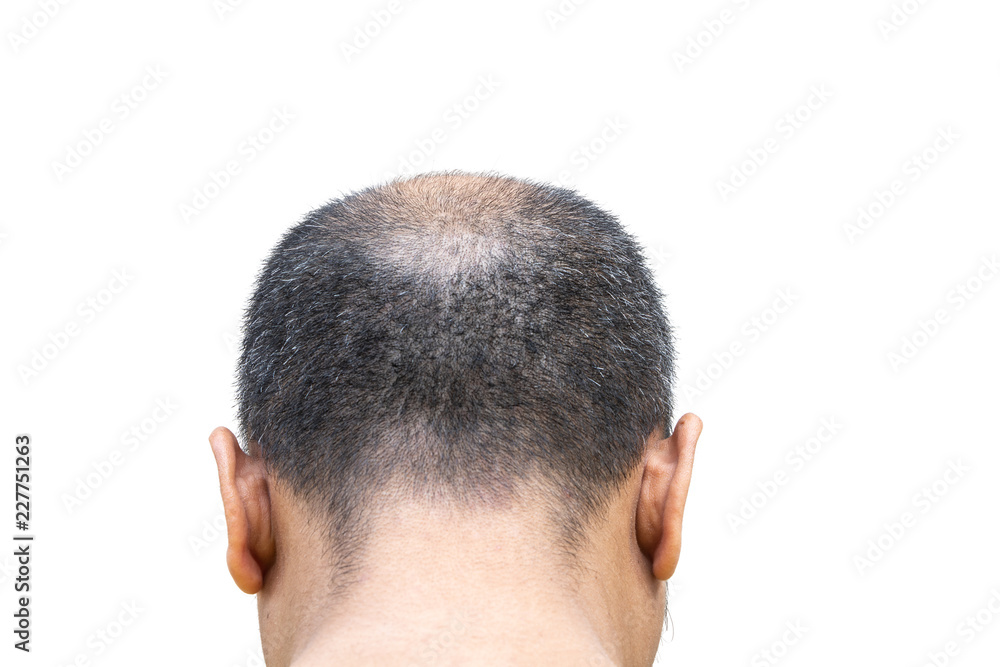 photo short bald man photo short bald man