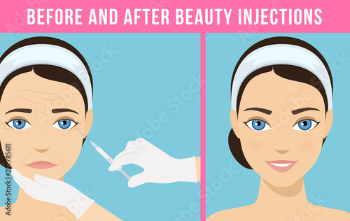Women's anti-aging skin care. Different types of facial wrinkles. Woman before and after Botox injection. Anti-aging procedure. Vector